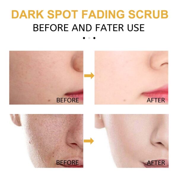 Eelhoe Turmeric Exfoliating Facial Scrub For Deep Cleansing Of Delicate Pores And Beauty Cleansing Treatment - Image 5